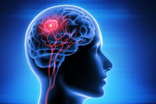 Aggressive cancer cells behave differently