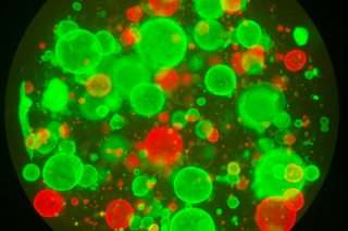 Genetic alterations interact with environmental and host factors